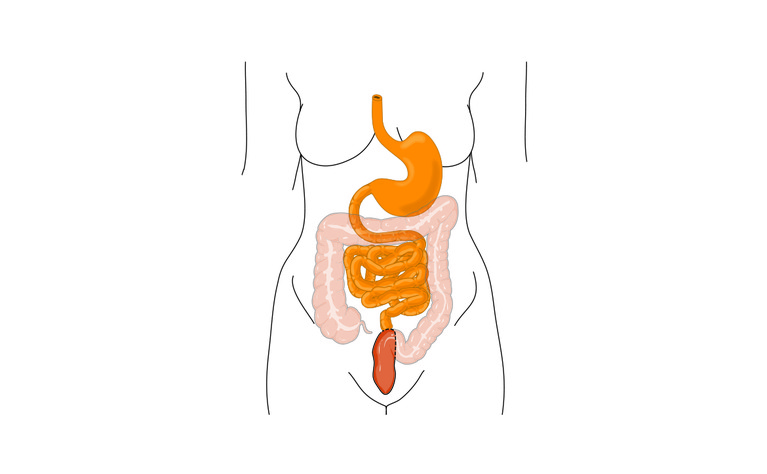 Colectomy with ileorectal anastomosis for inflammatory bowel disease (IBD)